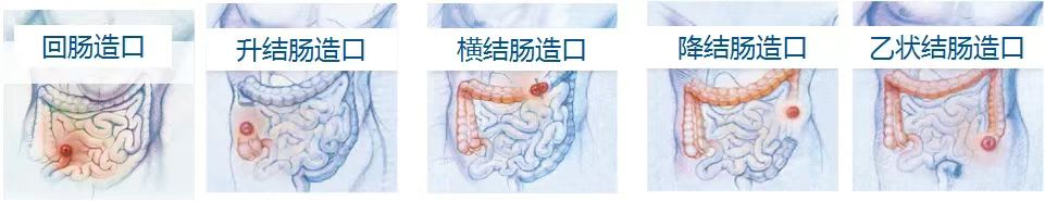 圖片 1.png 圖片 1.png